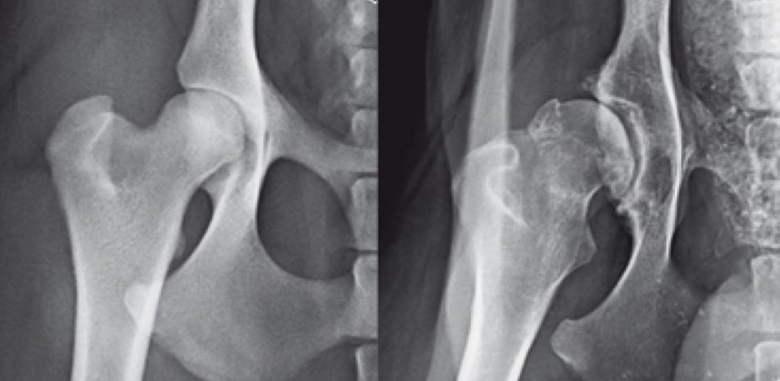 A side-by-side comparison of canine hip X-rays showing healthy and dysplastic joints.