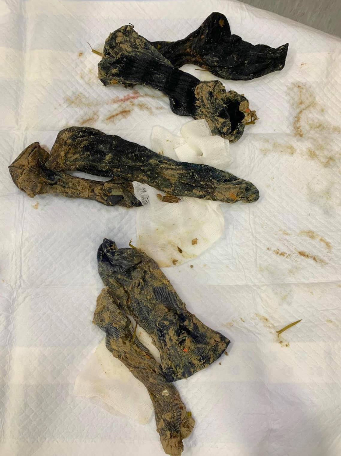 Post-surgical image of extracted foreign material, including fabric and plastic, from a dog's gastrointestinal system.